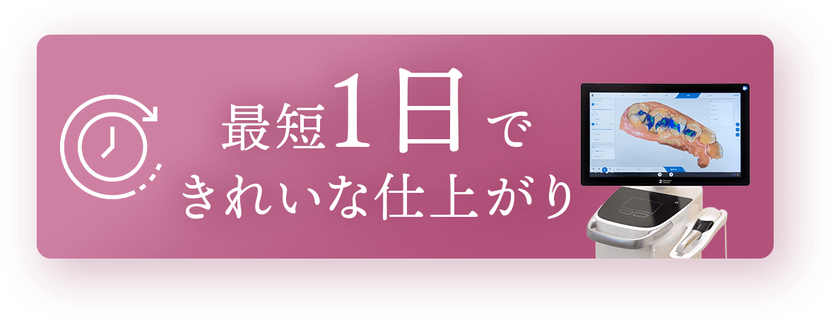 最短1日できれいな仕上がり