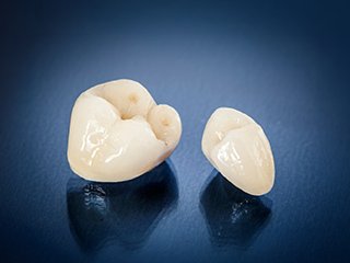 治療方法のご紹介 イメージ2