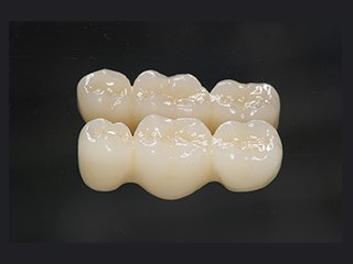 治療方法のご紹介 イメージ3