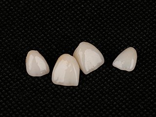 治療方法のご紹介 イメージ6