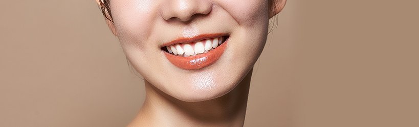 セラミックと銀歯の比較 イメージ